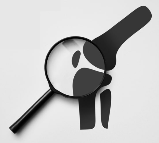 Proflexen na bóle stawów