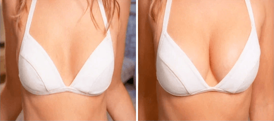 Bravona Forte opinie