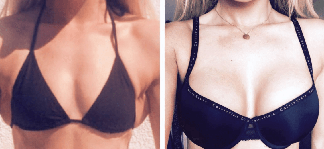 Bravona Forte opinie 3