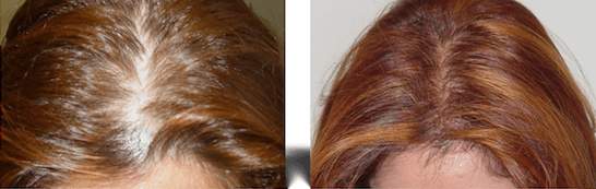 Hairstim efekty Hairstim efekty