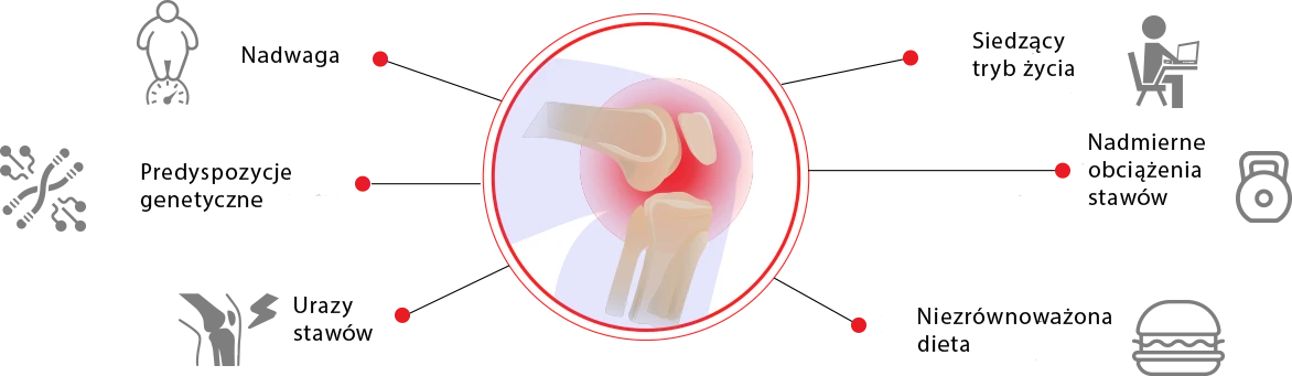 Cannabis Oil na stawy
