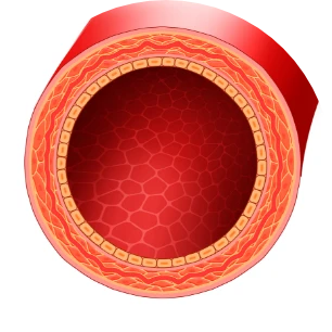 Cariovico po kuracji