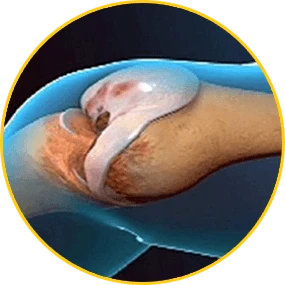 Hondrofrost działanie