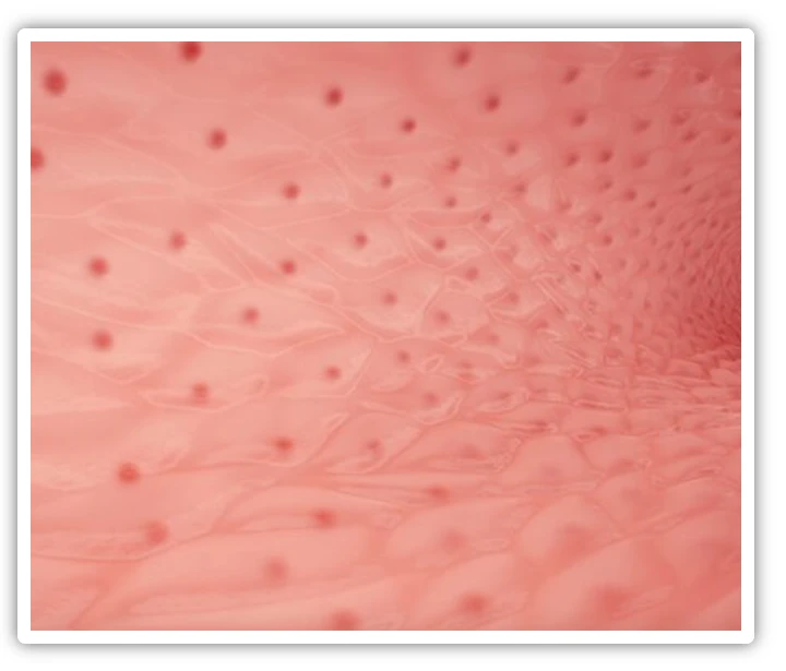 Varikosette działanie