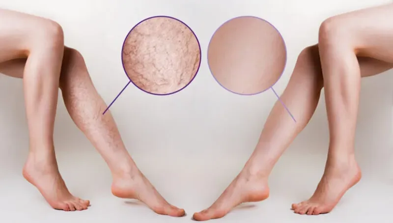 Veinaritin skuteczność