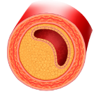 ravestin działanie (2)