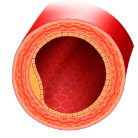 ravestin działanie (3)