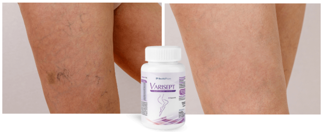 ovashape skuteczność