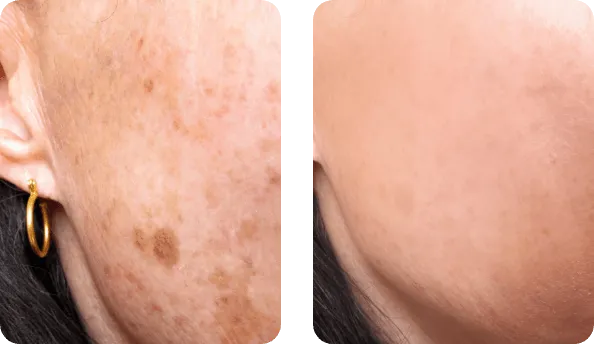 Eternelle Gold Night opinia 1