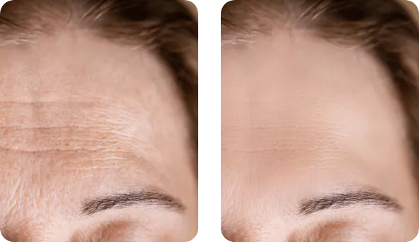 Eternelle Gold Night opinia 3