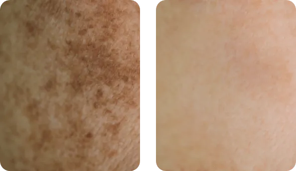 EternelleGold Night opinia 5